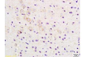 Formalin-fixed and paraffin embedded rat brain tissue labeled with Anti-ARHGAP32 Polyclonal Antibody, Unconjugated  at 1:200 followed by conjugation to the secondary antibody and DAB staining (ARHGAP32 抗体  (AA 860-896))