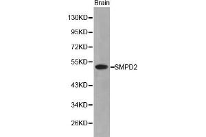 Western Blotting (WB) image for anti-Sphingomyelin phosphodiesterase 2, Neutral Membrane (Neutral Sphingomyelinase) (SMPD2) (AA 150-250) antibody (ABIN3021605) (SMPD2 抗体  (AA 150-250))