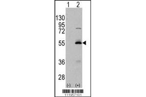 Western blot analysis of ALDH6A1 using rabbit polyclonal ALDH6A1 Antibody using 293 cell lysates (2 ug/lane) either nontransfected (Lane 1) or transiently transfected with the ALDH6A1 gene (Lane 2). (ALDH6A1 抗体  (C-Term))
