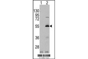 Western Blotting (WB) image for anti-Aldehyde Dehydrogenase 6 Family, Member A1 (ALDH6A1) (AA 367-396), (C-Term) antibody (ABIN5530270)