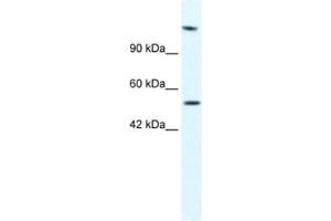 Western Blotting (WB) image for anti-DNA Helicase B (HELB) antibody (ABIN2461363) (DNA Helicase B 抗体)
