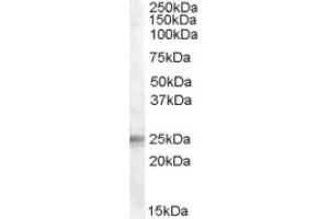 Image no. 1 for anti-Insulin-Like Growth Factor Binding Protein 6 (IGFBP6) (Internal Region) antibody (ABIN374965) (IGFBP6 抗体  (Internal Region))