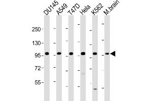All lanes : Anti-FGFR2 Antibody (N-term) at 1:1000-1:2000 dilution Lane 1: D whole cell lysate Lane 2: A549 whole cell lysate Lane 3: T47D whole cell lysate Lane 4: Hela whole cell lysate Lane 5: K562 whole cell lysate Lane 6: M.