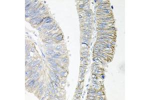 Immunohistochemistry (IHC) image for anti-ATPase, Na+/K+ Transporting, beta 1 Polypeptide (ATP1B1) (AA 63-303) antibody (ABIN6137306)