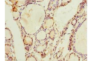 Immunohistochemistry of paraffin-embedded human thyroid tissue using ABIN7143477 at dilution of 1:100 (ARL11 抗体  (AA 2-196))