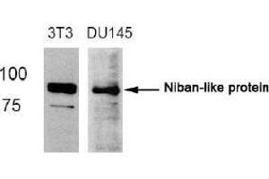 Image no. 2 for anti-Family with Sequence Similarity 129, Member B (FAM129B) (Ser712) antibody (ABIN319366) (MEG3 抗体  (Ser712))