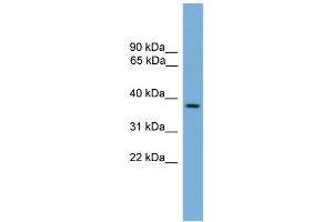 WB Suggested Anti-C14orf28 Antibody Titration: 0. (GM527 抗体  (Middle Region))