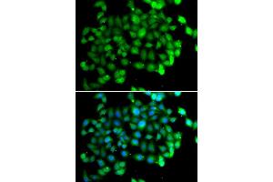 Immunofluorescence (IF) image for anti-Apolipoprotein B mRNA Editing Enzyme, Catalytic Polypeptide-Like 3C (APOBEC3C) antibody (ABIN1980244) (APOBEC3C 抗体)