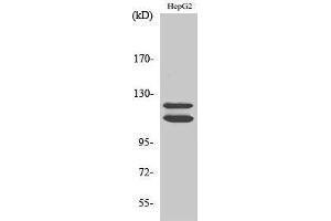 Western Blotting (WB) image for anti-Histone Deacetylase 5 (HDAC5) (C-Term) antibody (ABIN3176427) (HDAC5 抗体  (C-Term))