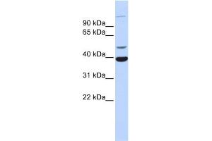WB Suggested Anti-ZNF124 Antibody Titration:  0. (ZNF124 抗体  (Middle Region))