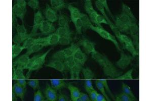 Immunofluorescence (IF) image for anti-Isocitrate Dehydrogenase 1 (NADP+), Soluble (IDH1) antibody (ABIN7256744)