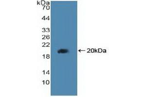 Detection of Recombinant PPARd, Human using Polyclonal Antibody to Peroxisome Proliferator Activated Receptor Delta (PPARd) (PPARD 抗体  (AA 260-426))