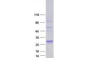 Validation with Western Blot (Surfactant Protein A1 Protein (SFTPA1) (Transcript Variant 6) (Myc-DYKDDDDK Tag))