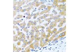 Immunohistochemistry of paraffin-embedded human liver using CCL21 antibody at dilution of 1:100 (40x lens). (CCL21 抗体)