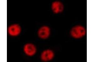 ABIN6277580 staining  HeLa cells by IF/ICC.