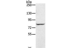 Western Blot analysis of Jurkat cell using RNF43 Polyclonal Antibody at dilution of 1:300 (RNF43 抗体)