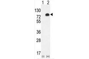 Western blot analysis of GPC6 (arrow) using rabbit polyclonal GPC6 Antibody (C-term) . (Glypican 6 抗体  (C-Term))