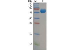 Human B7-H5 Protein, hFc Tag on SDS-PAGE under reducing condition. (VTCN1 Protein (Fc Tag))