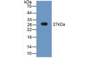 Detection of Recombinant TUBd, Rat using Polyclonal Antibody to Tubulin Delta (TUBd) (TUBD1 抗体  (AA 238-482))
