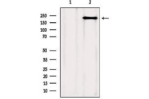 Western blot analysis of extracts from Mouse spleen, using mTOR Antibody.