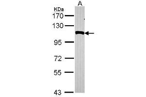 WB Image Sample (30 ug of whole cell lysate) A: Hela 7. (NPEPPS 抗体)