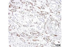 IHC testing of FFPE human kidney transplant tissue (10X) stained with C4d antibody (C4D204). (Complement C4d 抗体)