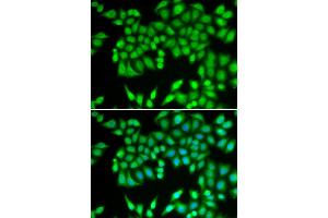 Immunofluorescence analysis of U2OS cells using MCM3 antibody (ABIN5970419). (MCM3 抗体)