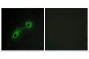 Immunofluorescence analysis of HeLa cells, using CAMK5 Antibody. (CAMKV 抗体)