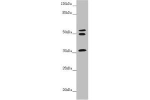 Western blot All lanes: RNF41 antibody at 5. (RNF41 抗体  (AA 1-317))