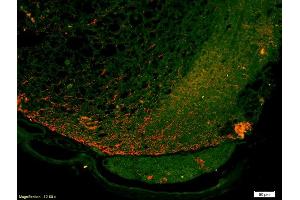 Formalin-fixed and paraffin-embedded injured rat spinal cord labeled with Anti-FPRL1 Polyclonal Antibody, Unconjugated (ABIN702175) 1:200, overnight at 4°C, The secondary antibody was Goat Anti-Rabbit IgG, Alexa Fluor 647 conjugated used at 1:200 dilution for 40 minutes at 37°C. (FPR2 抗体  (AA 51-150))