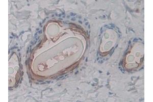 Immunohistochemistry (IHC) image for anti-Advanced Glycosylation End Product-Specific Receptor (AGER) (AA 180-402) antibody (ABIN7443794)