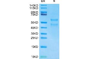 Human Latent TGF beta 3 on Tris-Bis PAGE under reduced condition.