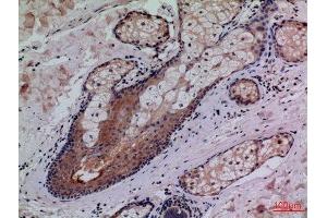 Immunohistochemistry (IHC) analysis of paraffin-embedded Human Skin, antibody was diluted at 1:100.