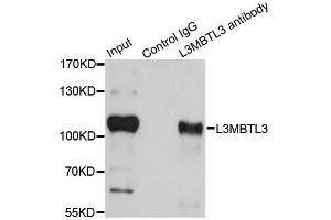 Immunoprecipitation analysis of 200ug extracts of HeLa cells using 1ug L3MBTL3 antibody. (L3MBTL3 抗体)