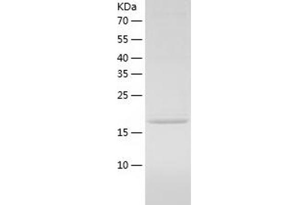 SRP14 Protein (AA 1-160) (His tag)