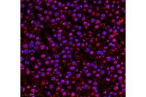 Immunofluorescence of paraffin embedded rat liver using AQP0 (ABIN7074547) at dilution of 1: 300 (400x lens) (MIP 抗体)
