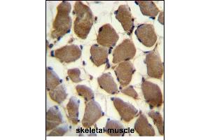 LRP3 Antibody (C-term) (ABIN390097 and ABIN2840611) immunohistochemistry analysis in formalin fixed and paraffin embedded human skeletal muscle followed by peroxidase conjugation of the secondary antibody and DAB staining. (LRP3 抗体  (C-Term))
