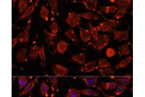 Immunofluorescence analysis of L929 cells using ITSN2 Polyclonal Antibody at dilution of 1:100.