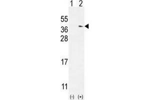 Western blot analysis of TXNDC6 (arrow) using rabbit polyclonal TXNDC6 Antibody (Center) . (NME9 抗体  (Middle Region))