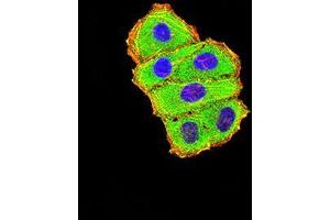 Immunofluorescence analysis of Hela cells using C3C mouse mAb (green). (Complement C3c 抗体  (AA 1521-1649))