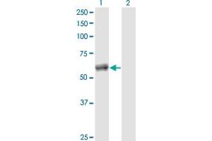 Western Blot analysis of CALCOCO2 expression in transfected 293T cell line by CALCOCO2 monoclonal antibody (M04), clone 2A11. (CALCOCO2 抗体  (AA 347-446))