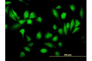 Immunofluorescence of monoclonal antibody to RPS5 on HeLa cell.