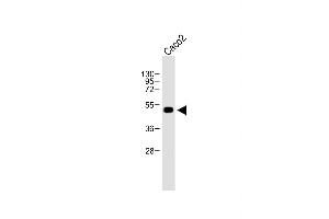 Anti-WTIP Antibody (C-term) at 1:500 dilution + Caco2 whole cell lysate Lysates/proteins at 20 μg per lane. (WTIP 抗体  (AA 243-271))