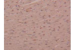 IHC-P analysis of Mouse Heart Tissue, with DAB staining. (alpha 2 Macroglobulin 抗体  (AA 1053-1214))