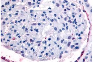 Anti-EPHA4 antibody  ABIN1048570 IHC staining of human kidney, glomerulus. (EPH Receptor A4 抗体  (Internal Region))