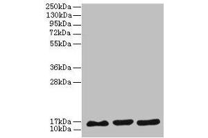 Western blot All lanes: SYNJ2BP antibody at 3 μg/mL Lane 1: MCF-7 whole cell lysate Lane 2: U251 whole cell lysate Lane 3: Caco-2 whole cell lysate Secondary Goat polyclonal to rabbit IgG at 1/10000 dilution Predicted band size: 16 kDa Observed band size: 16 kDa (SYNJ2BP 抗体  (AA 1-117))