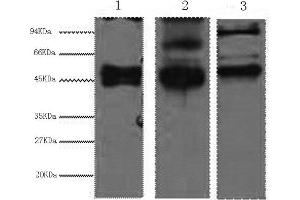 Western Blotting (WB) image for anti-Keratin 17 (KRT17) antibody (ABIN5959216) (KRT17 抗体)