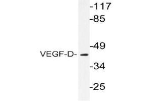 Western blot (WB) analyzes of VEGF-D antibody in extracts from COS-7 cells. (VEGFD 抗体)
