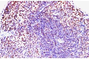 Immunohistochemistry of paraffin-embedded Mouse spleen using IFNAR1 Polyclonl Antibody at dilution of 1:200. (IFNAR1 抗体)