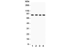 Western blot testing of IKKb antibody and Lane 1:  HEPG2;  2: COLO320;  3: M231;  4: HT1080 lysate. (IKBKB 抗体  (AA 398-756))